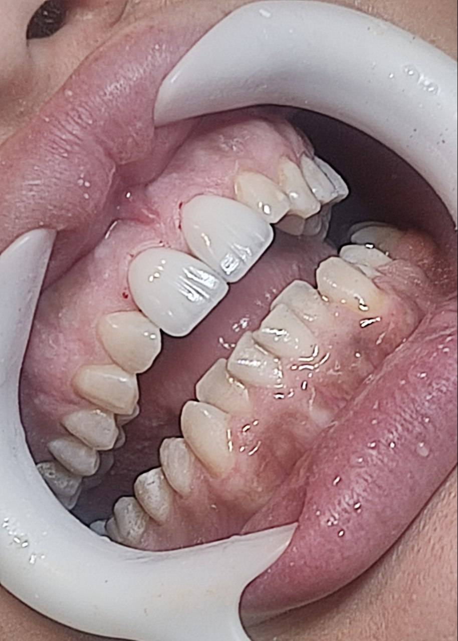 دندانپزشکی در بلوار 