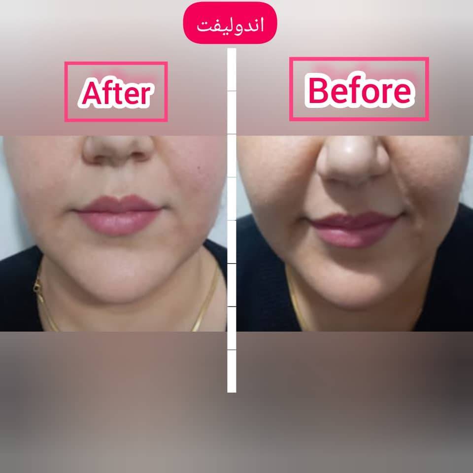 کلینیک زیبایی در قائم مقام فراهانی 