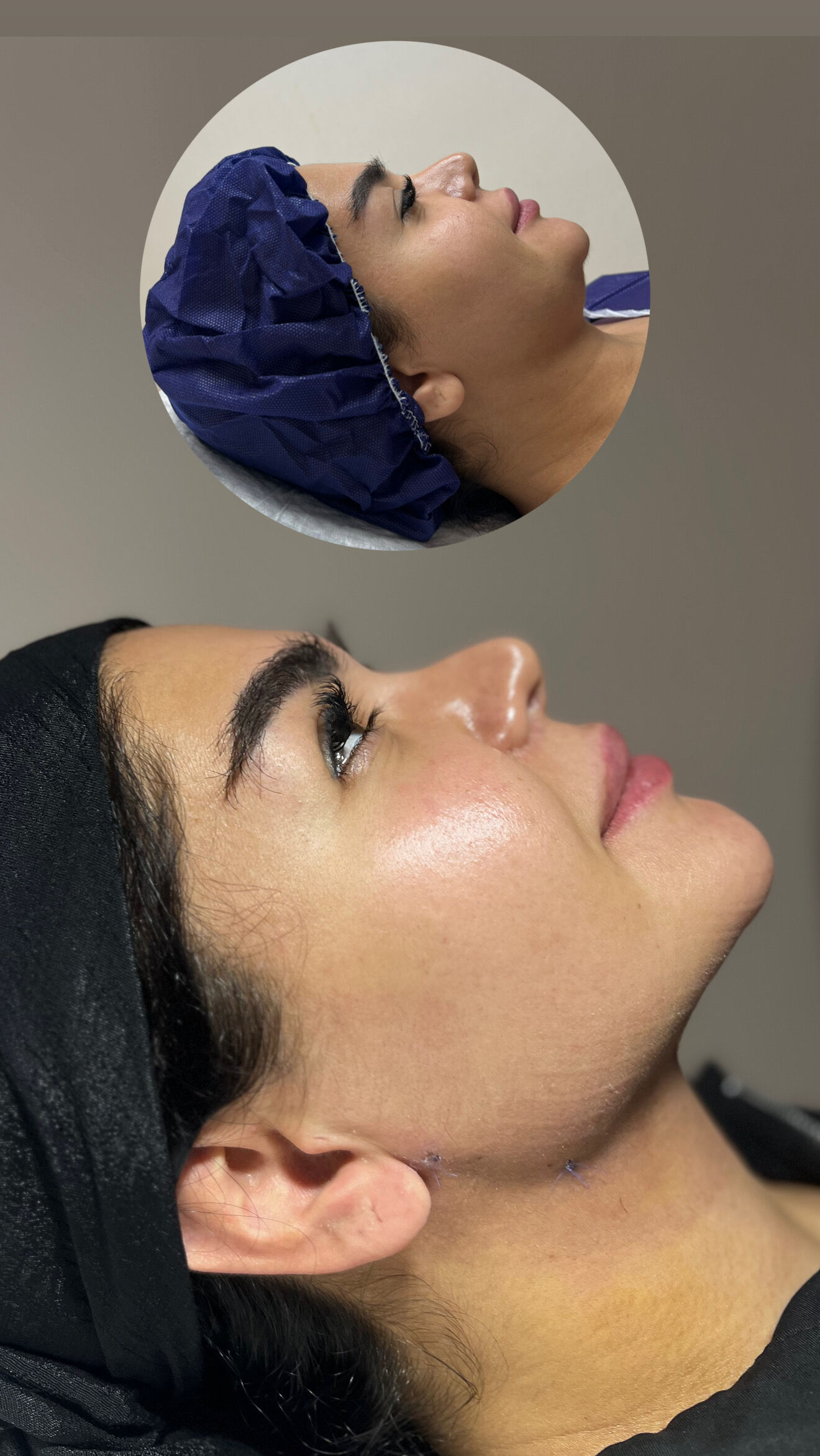 کلینیک زیبایی در سعادت آباد