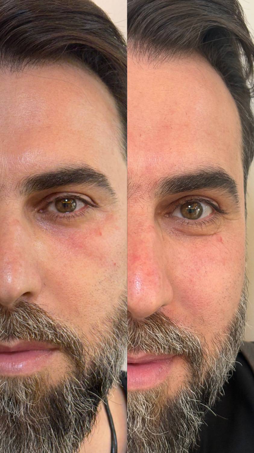 بن کارت را وارد کنید 