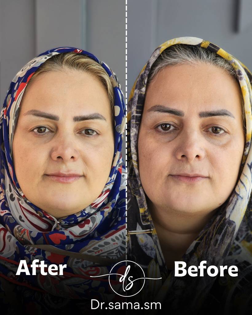 بن کارت را وارد کنید 