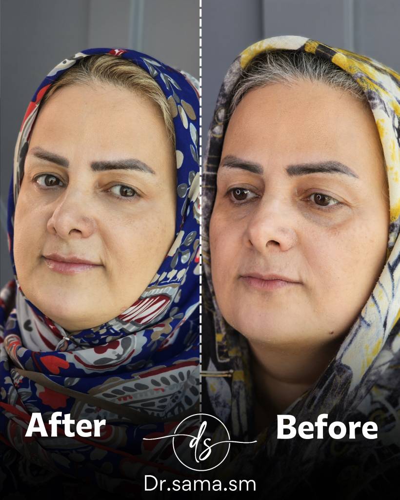 بن کارت را وارد کنید 