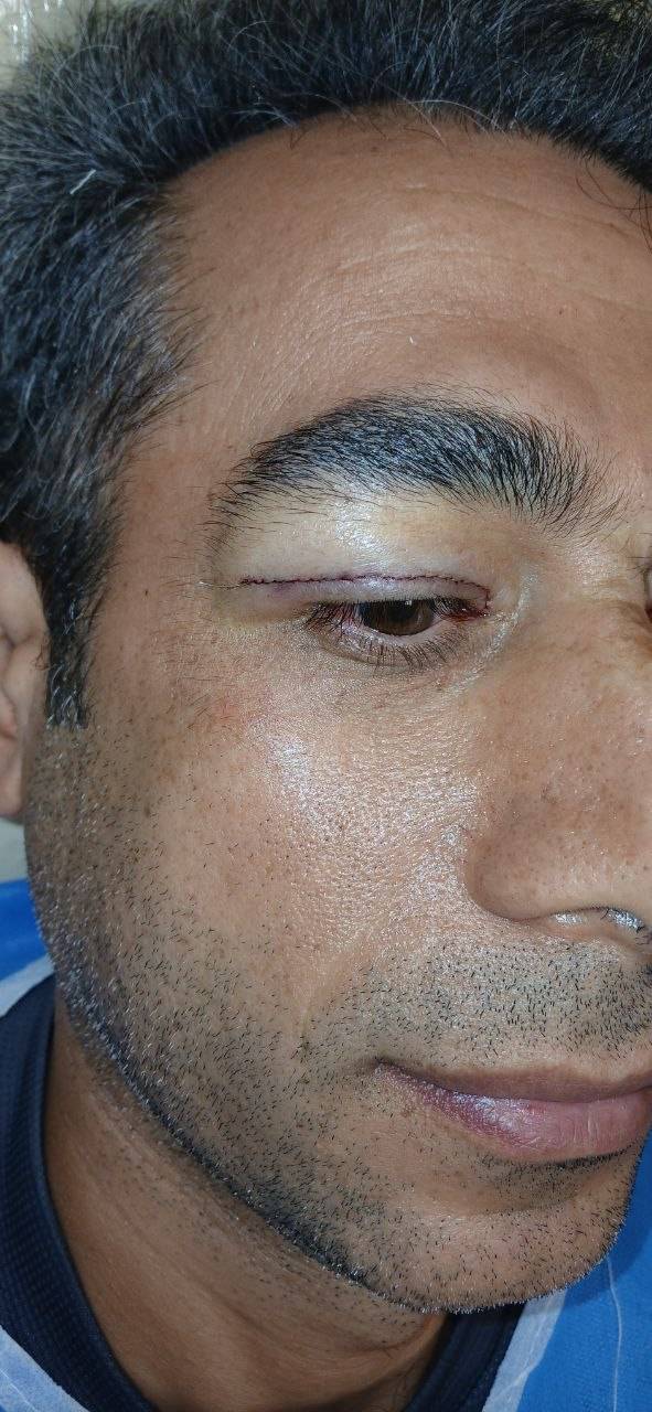 کلینیک زیبایی و پوست در نازی آباد 