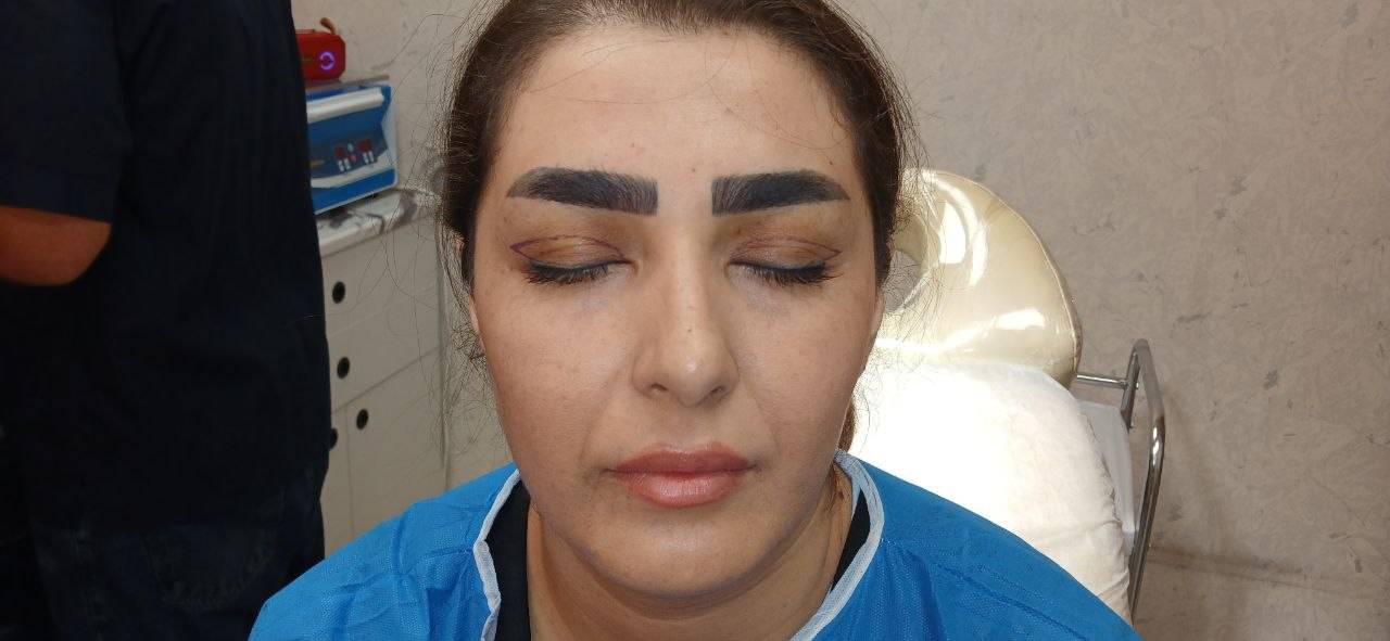 کلینیک زیبایی و پوست در نازی آباد 