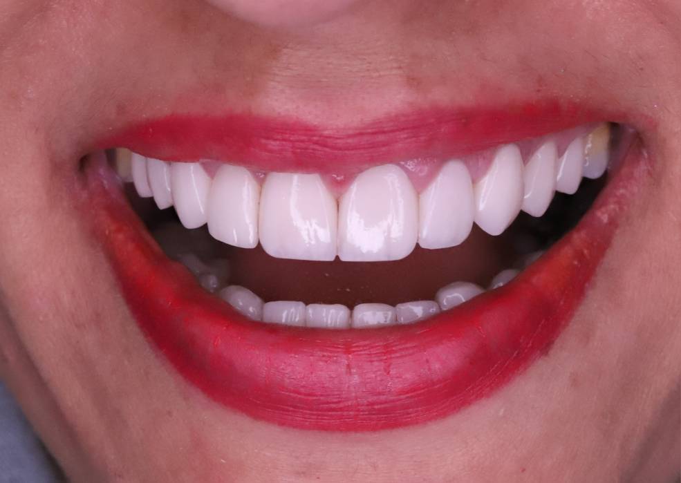 کد بن کارت را وارد کنید