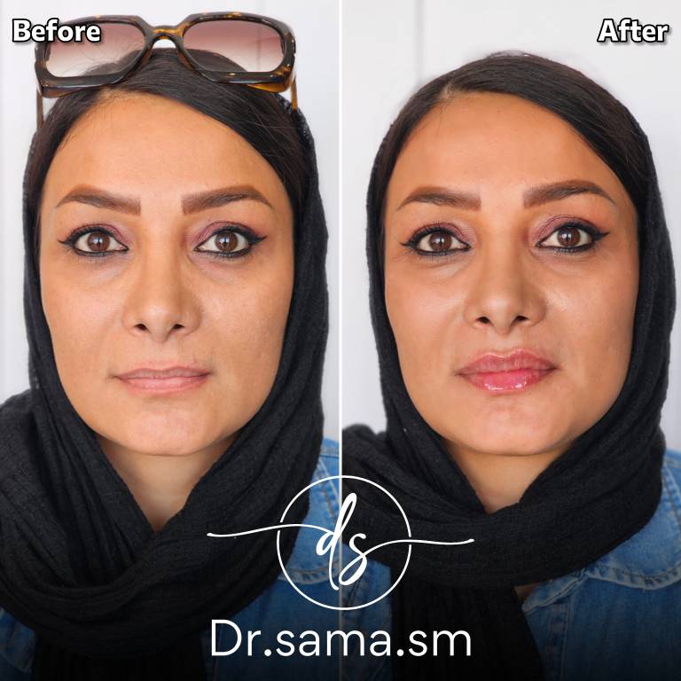 بن کارت را وارد کنید 