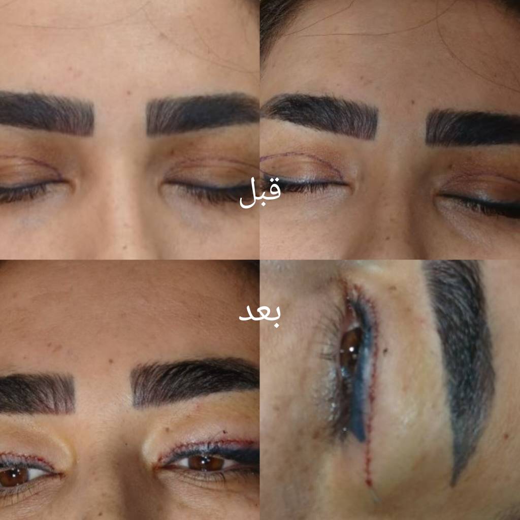 کلینیک زیبایی و پوست در نازی آباد 