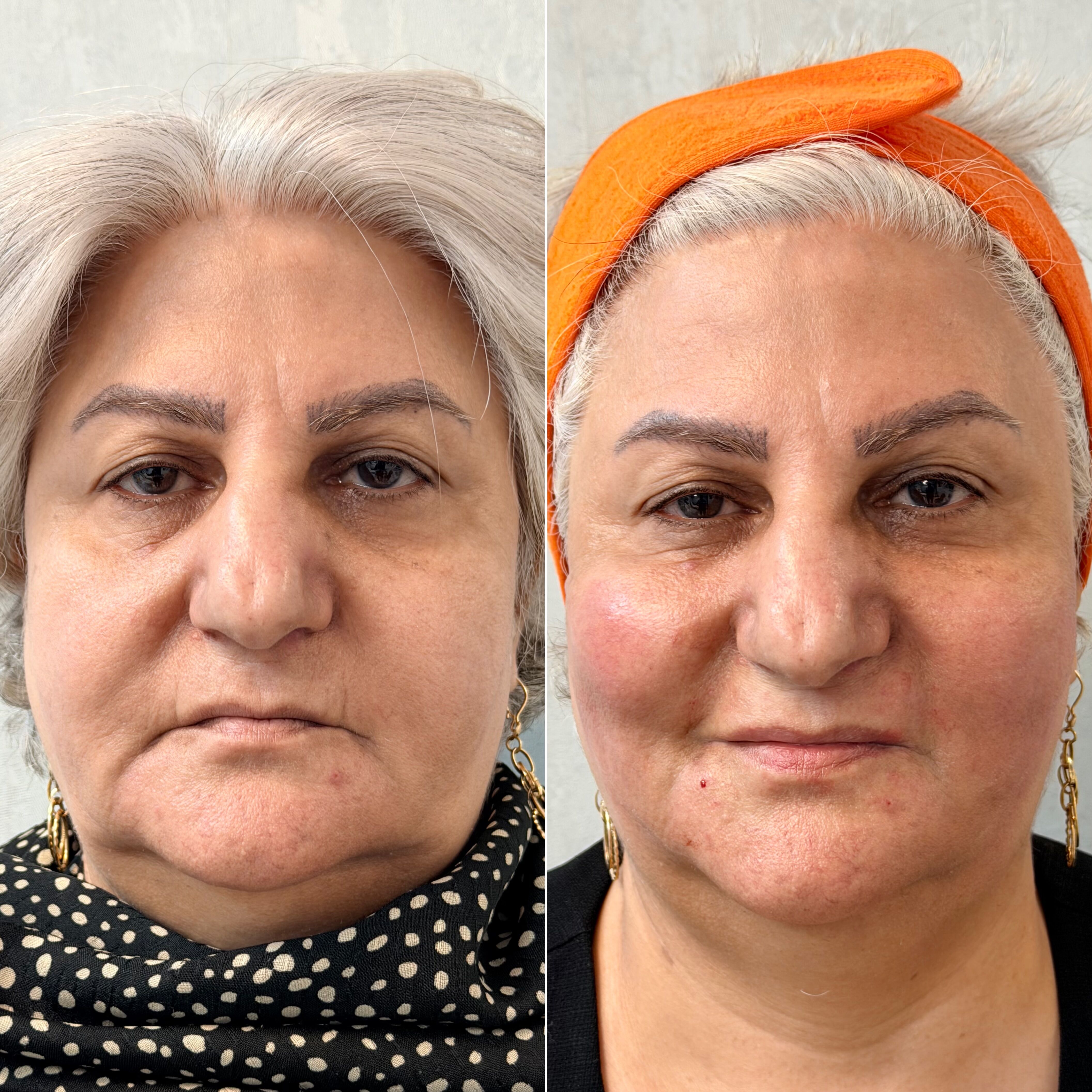 کد بن کارت را وارد کنید