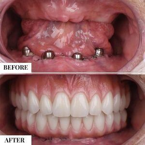 دندانپزشکی تخصصی در زعفرانیه و پیروزی 