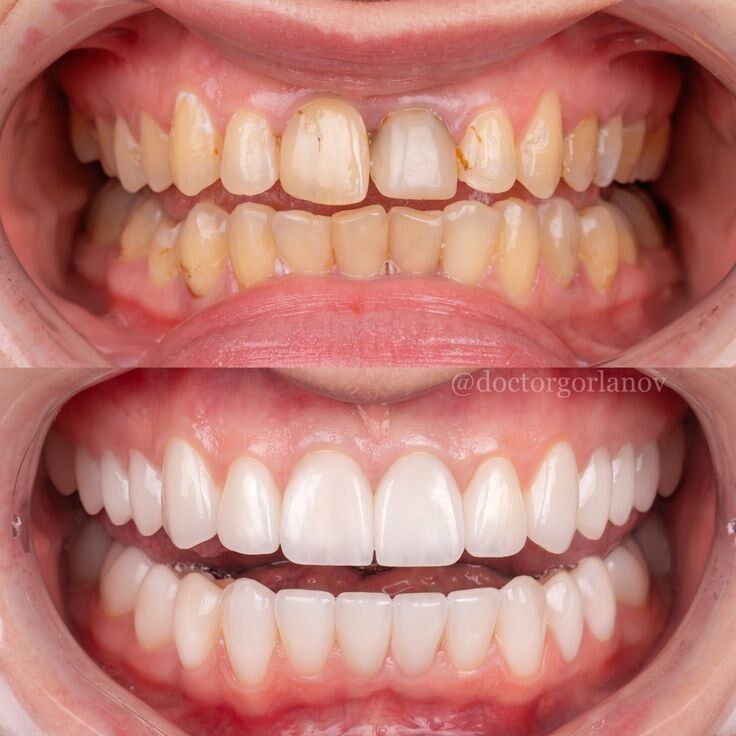 دندانپزشکی تخصصی در زعفرانیه و پیروزی 
