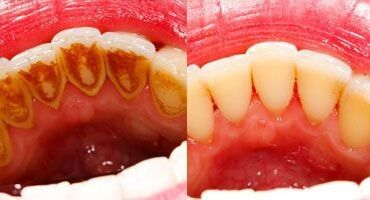 دندانپزشکی تخصصی در زعفرانیه و پیروزی 