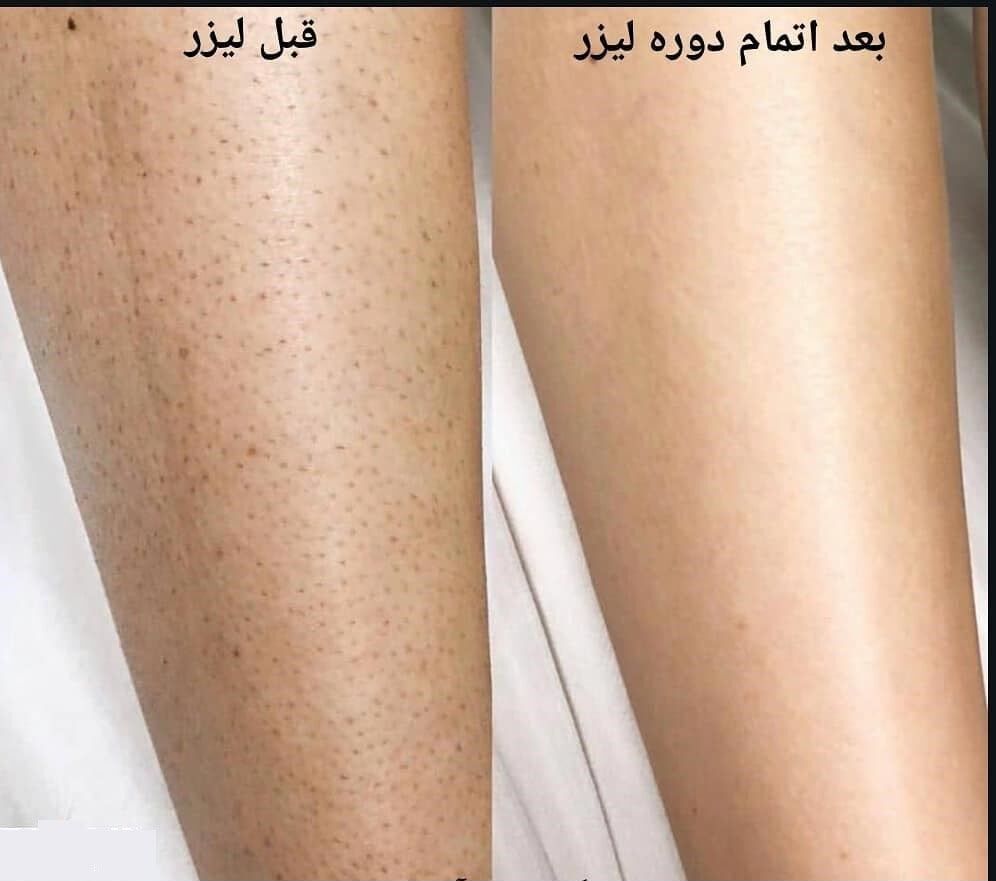 کلینیک زیبایی در شهرری 