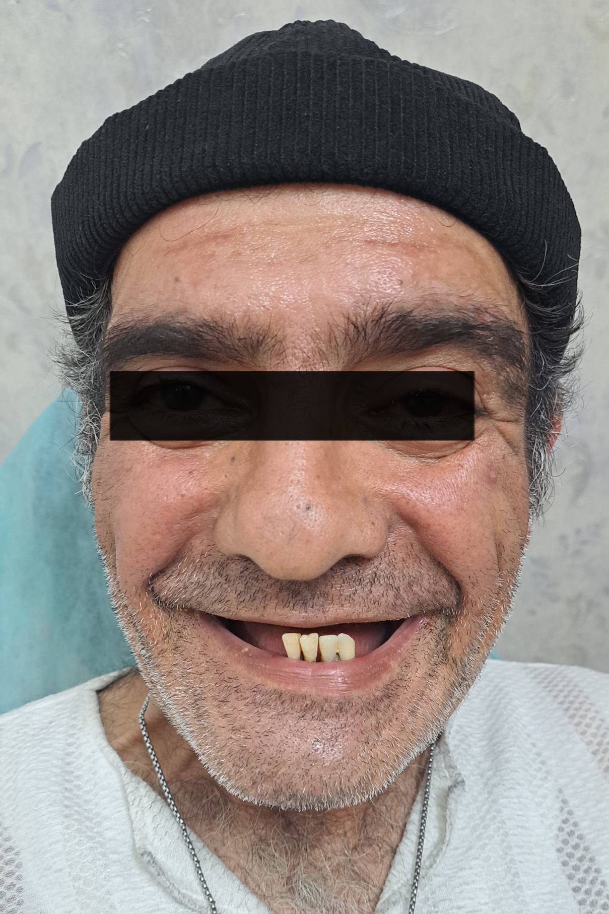دندانسازی