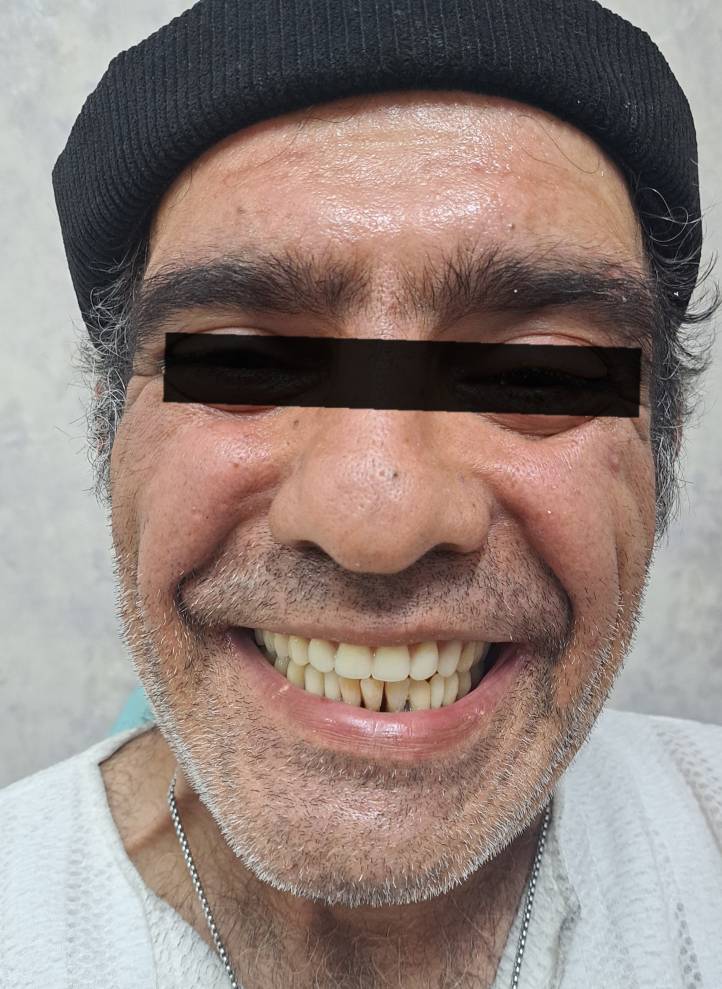 دندانسازی