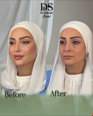 کلینیک زیبایی در قیطریه 