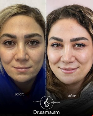 کلینیک زیبایی و پوست در اشرفی اصفهانی 