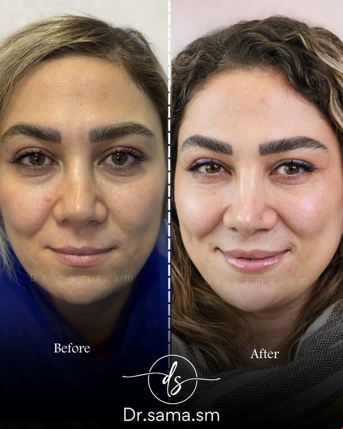 کلینیک زیبایی و پوست در اشرفی اصفهانی 