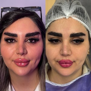 کلینیک کاشت ابرو و زیبایی و لاغری در جردن 