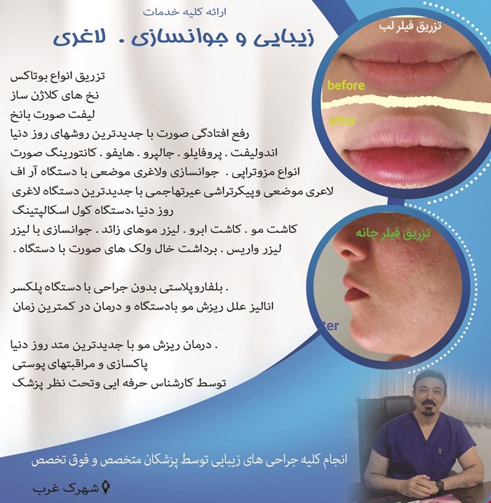 انجام کلیه جراحی های زیبایی توسط پزشکان متخصص و فوق تخصص در شهرک غرب 