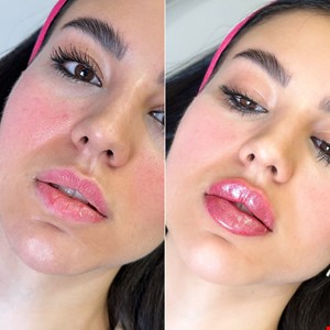کلینیک زیبایی در شریعتی جنب حسینیه ارشاد