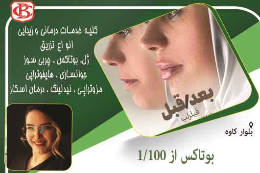 بوتاکس پیشانی،خط اخم،پنجه کلاغی،خطوط روی بینی