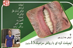 ایمپلنت. اوردنچر. جراحی دندان عقل